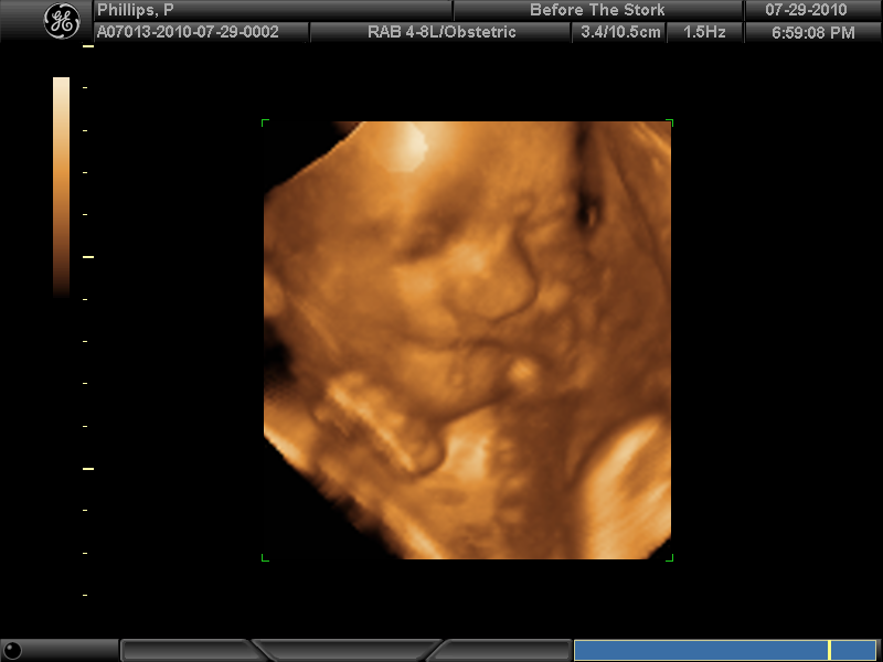 BABY BOY PHILLIPS #2_24