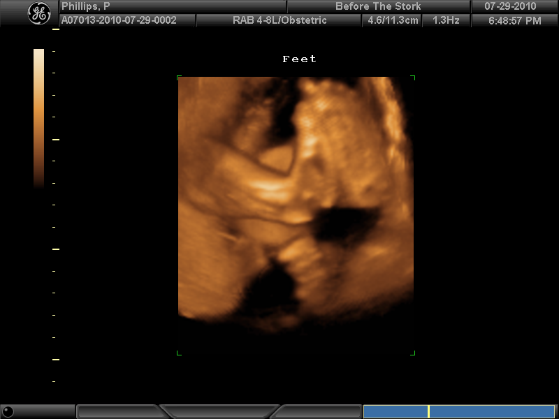 BABY BOY PHILLIPS #2_6